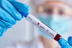 Planos de saúde terão de cobrir a realização de testes    de covid-19