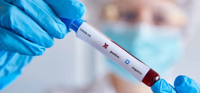 Planos de saúde terão de cobrir a realização de testes    de covid-19