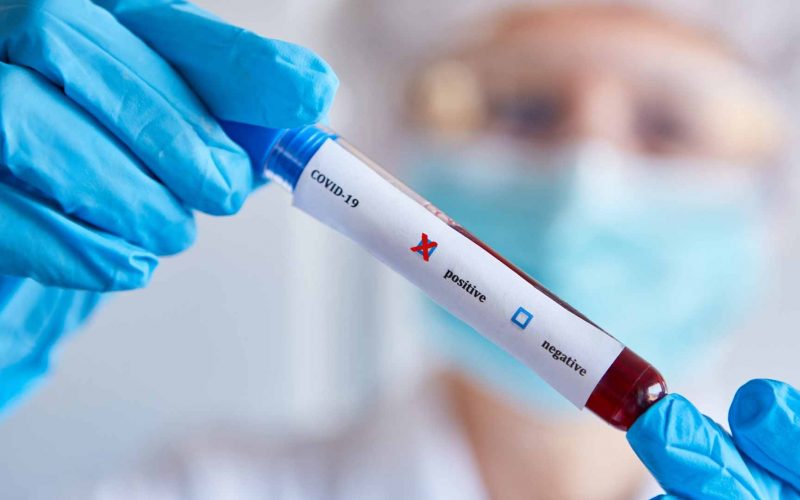 Planos de saúde terão de cobrir a realização de testes    de covid-19